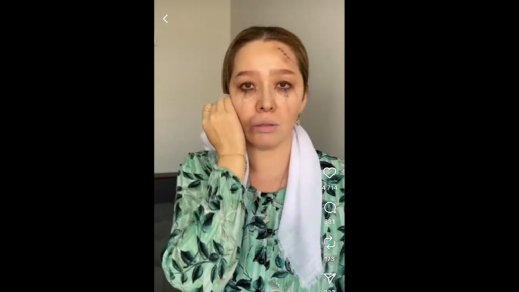 Учителя одной из школ Актау пришли на работу с синяками и ссадинами учитель