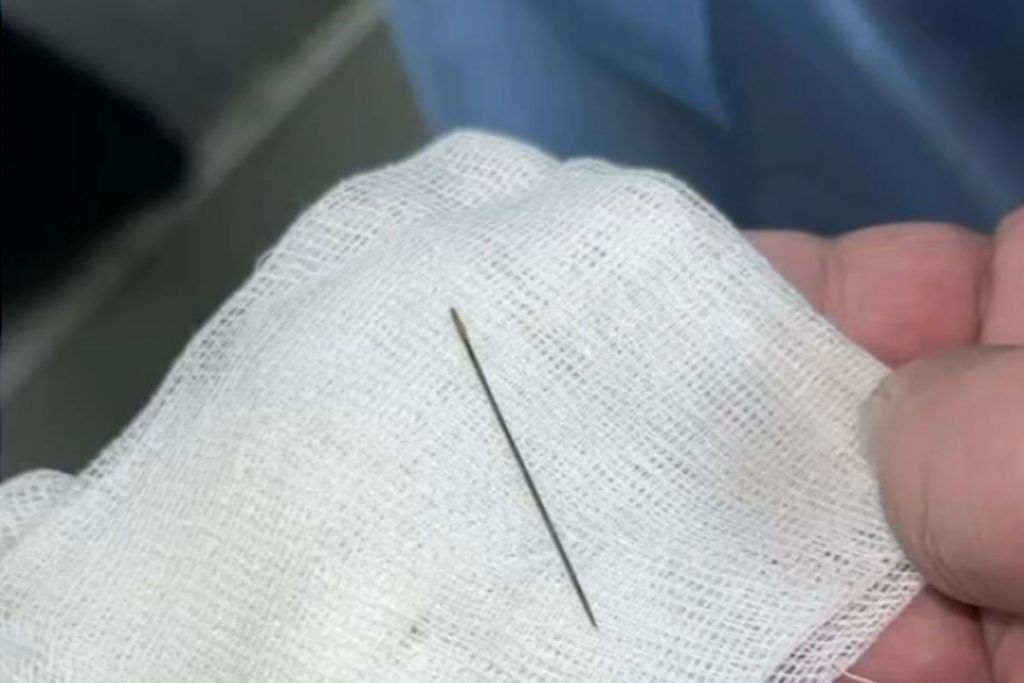 Иглу в животе 8-месячного ребенка нашли врачи в Туркестане